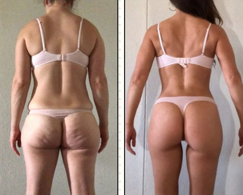 BootySculpt Pro™ – Levanta, tonifica y moldea tus glúteos sin esfuerzo